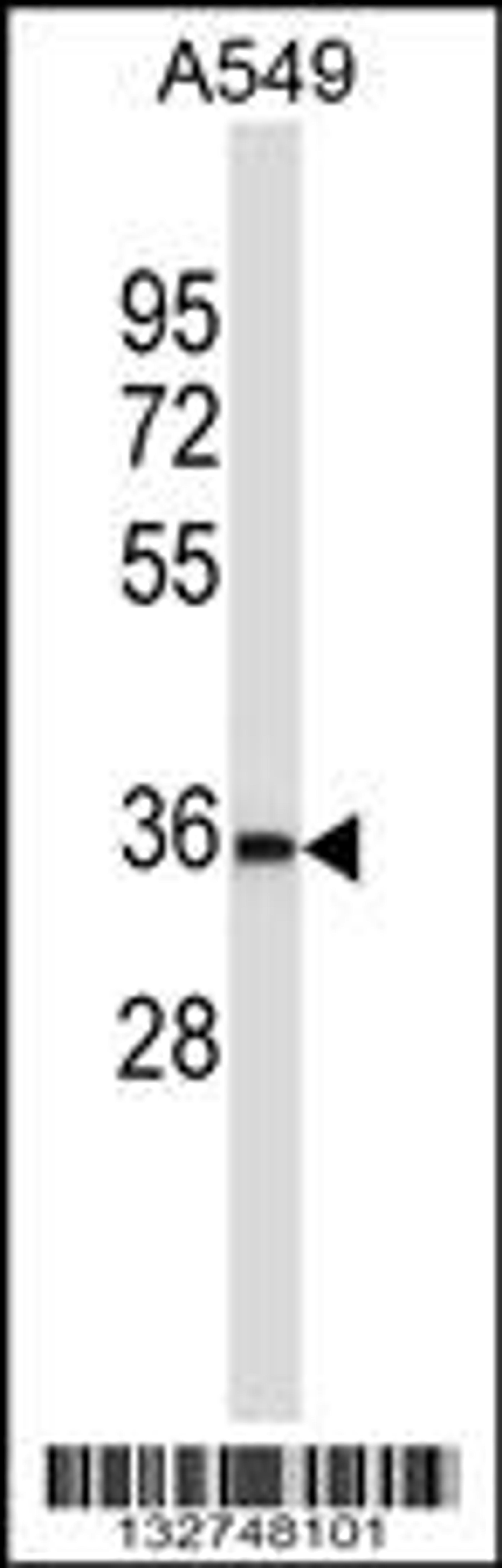 Western blot analysis in A549 cell line lysates (35ug/lane).