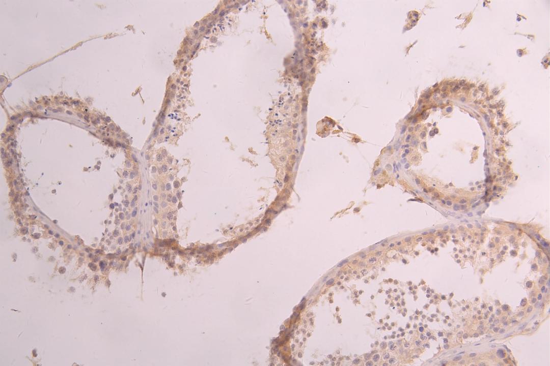 IHC image of CSB-RA001950MA2HU diluted at 1:50 and staining in paraffin-embedded human testis tissue performed on a Leica BondTM system. After dewaxing and hydration, antigen retrieval was mediated by high pressure in a citrate buffer (pH 6.0). Section was blocked with 10% normal goat serum 30min at RT. Then primary antibody (1% BSA) was incubated at 4°C overnight. The primary is detected by a Goat anti-human polymer IgG labeled by HRP and visualized using 0.05% DAB.
