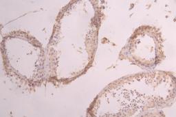 IHC image of CSB-RA001950MA2HU diluted at 1:50 and staining in paraffin-embedded human testis tissue performed on a Leica BondTM system. After dewaxing and hydration, antigen retrieval was mediated by high pressure in a citrate buffer (pH 6.0). Section was blocked with 10% normal goat serum 30min at RT. Then primary antibody (1% BSA) was incubated at 4°C overnight. The primary is detected by a Goat anti-human polymer IgG labeled by HRP and visualized using 0.05% DAB.