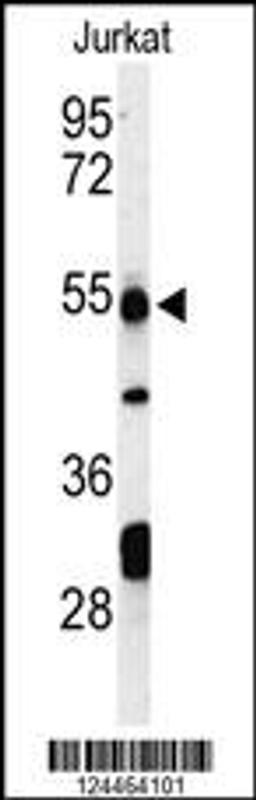 Western blot analysis of PRUNE Antibody in Jurkat cell line lysates (35ug/lane)