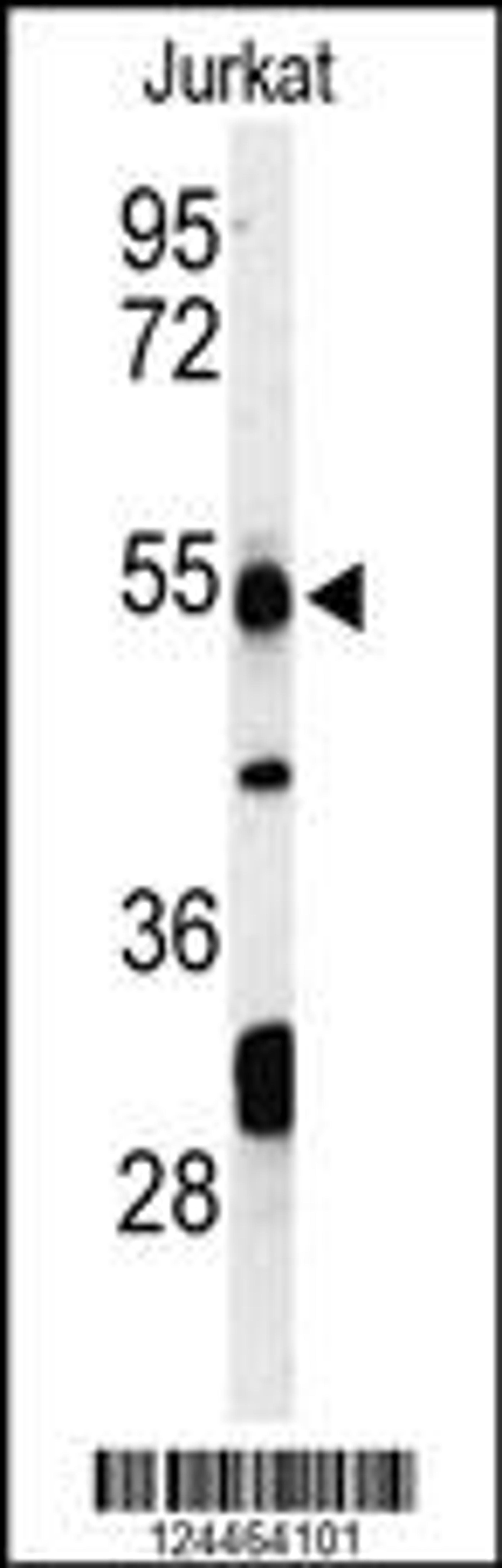 Western blot analysis of PRUNE Antibody in Jurkat cell line lysates (35ug/lane)