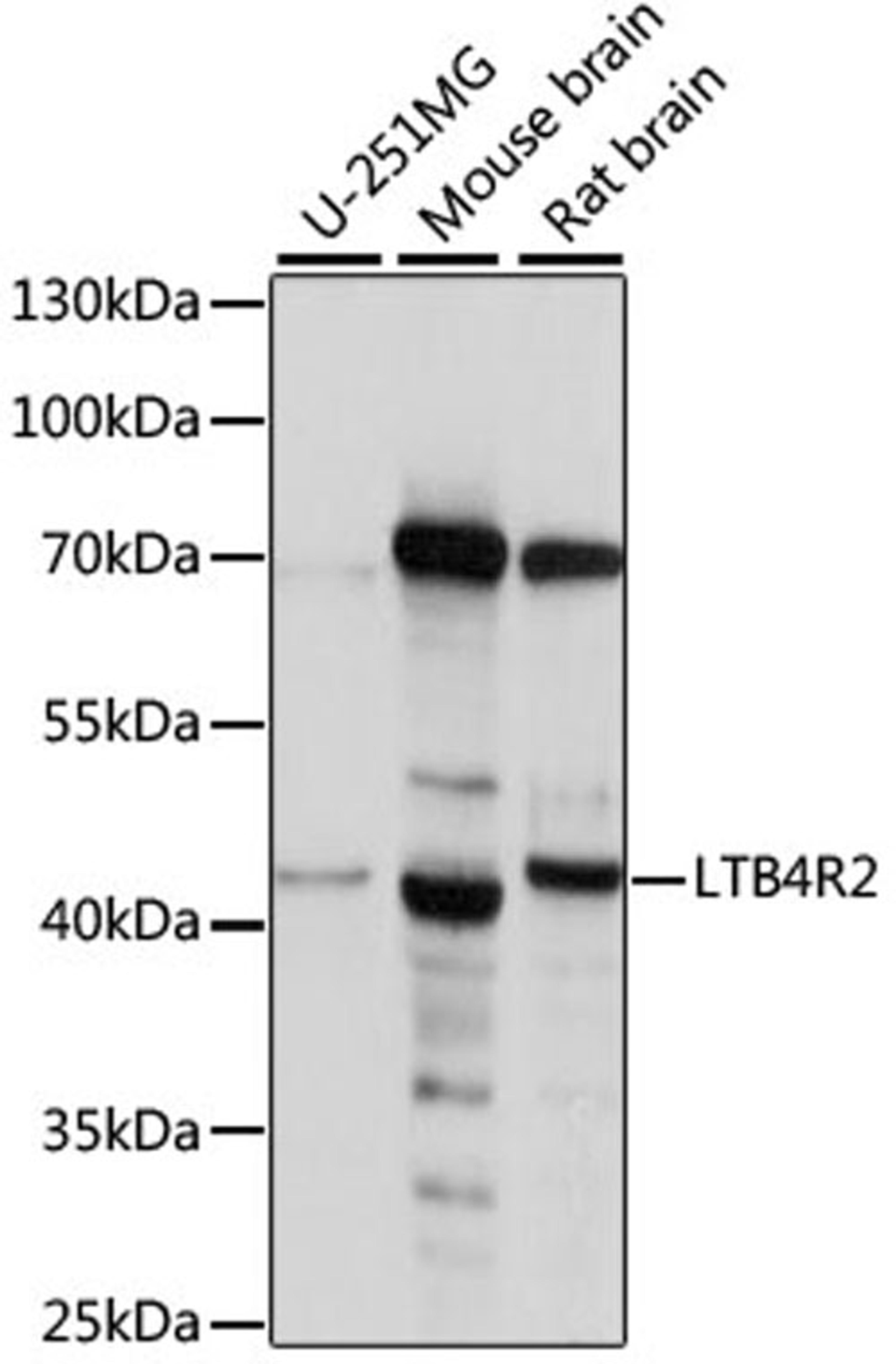 Western blot - LTB4R2 antibody (A15479)