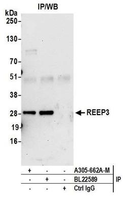 Detection of human REEP3 by WB of IP.