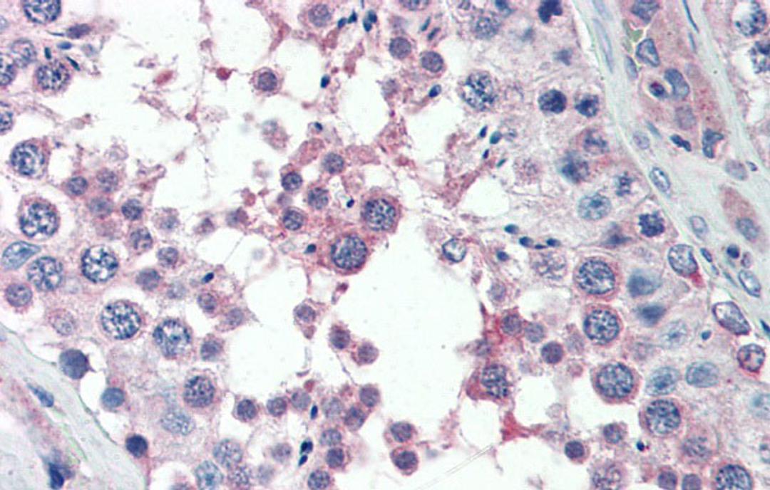 Antibody used in IHC on Human Testis at 5.0 ug/ml.