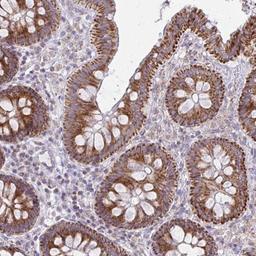 Immunohistochemistry-Paraffin: MRPL19 Antibody [NBP2-33795] - Immunohistochemical staining of human colon shows strong granular cytoplasmic positivity in glandular cells.