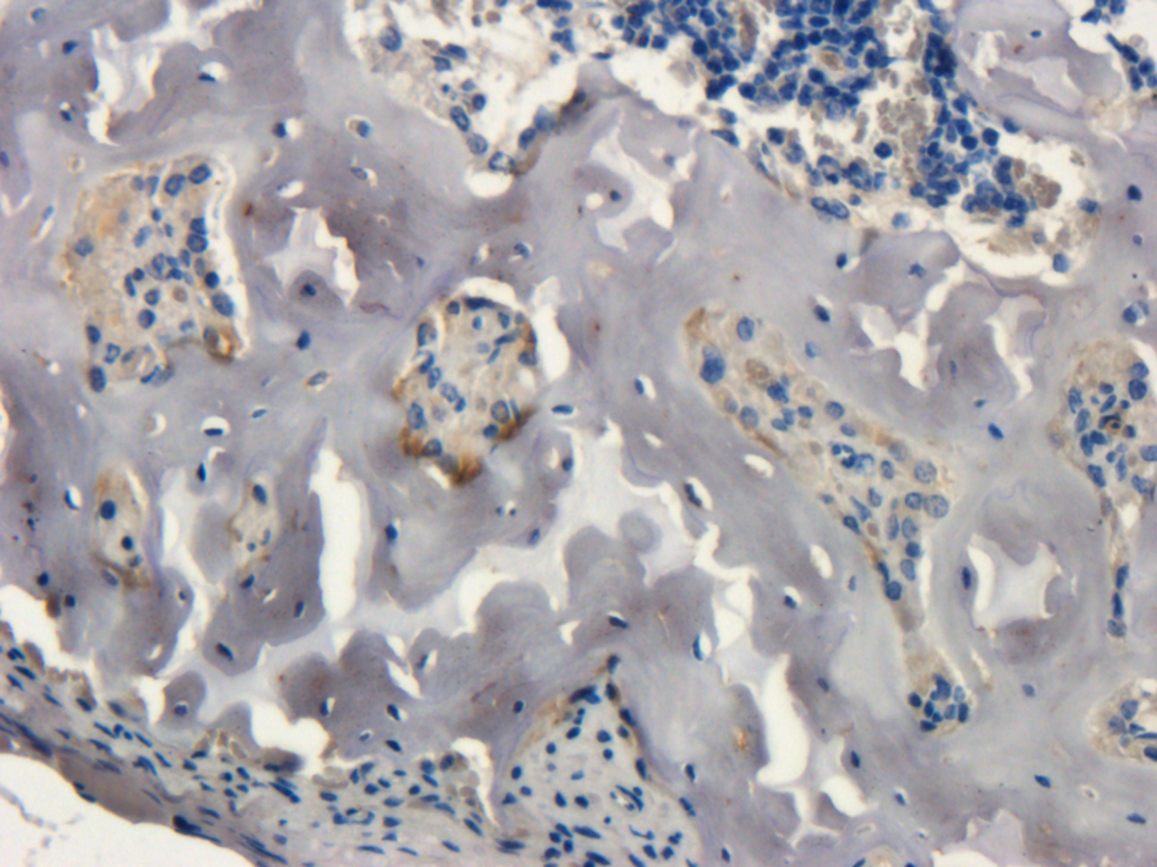 Immunohistochemical staining of paraffin embedded mouse bone marrow tissue using anti-Collagen X (2.5 ug/ml)