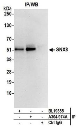 Detection of human SNX8 by western blot of immunoprecipitates.