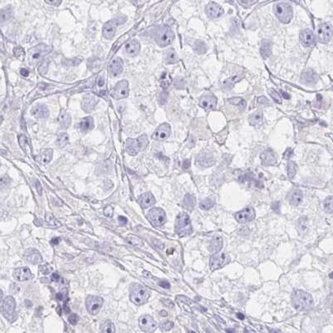 Immunohistochemistry: LRRC36 Antibody [NBP2-31721] - testis cancer