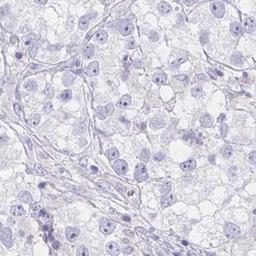 Immunohistochemistry: LRRC36 Antibody [NBP2-31721] - testis cancer