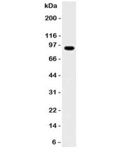 Western blot testing of Daudi lysate with MALT1 antibody. Expected molecular weight ~92 kDa.