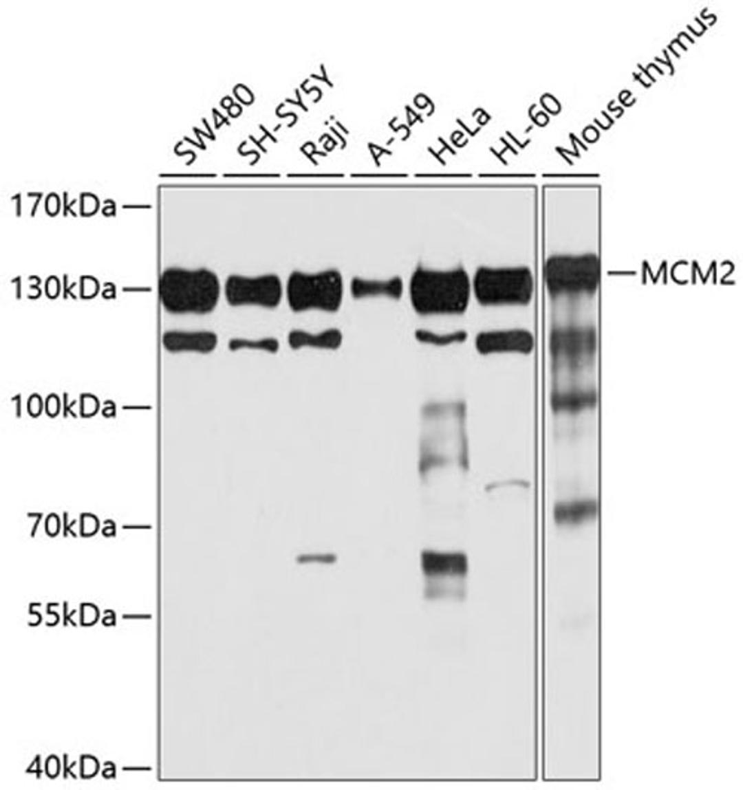 Western blot - MCM2 antibody (A1056)