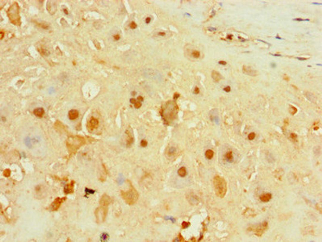 Immunohistochemistry of paraffin-embedded human placenta tissue using CSB-PA880143LA01HU at dilution of 1:100