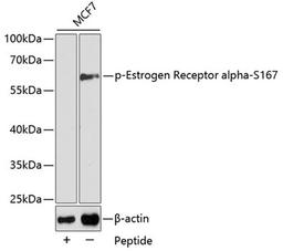 Western blot - Phospho-Estrogen Receptor alpha-S167 antibody (AP0348)