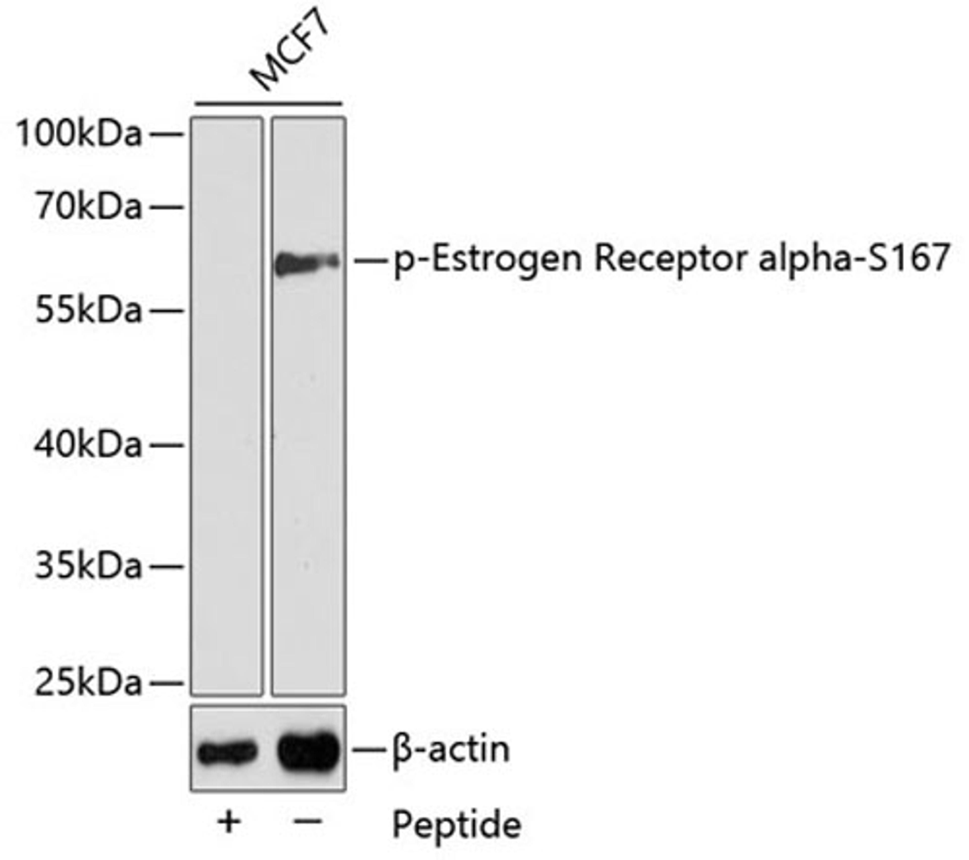 Western blot - Phospho-Estrogen Receptor alpha-S167 antibody (AP0348)