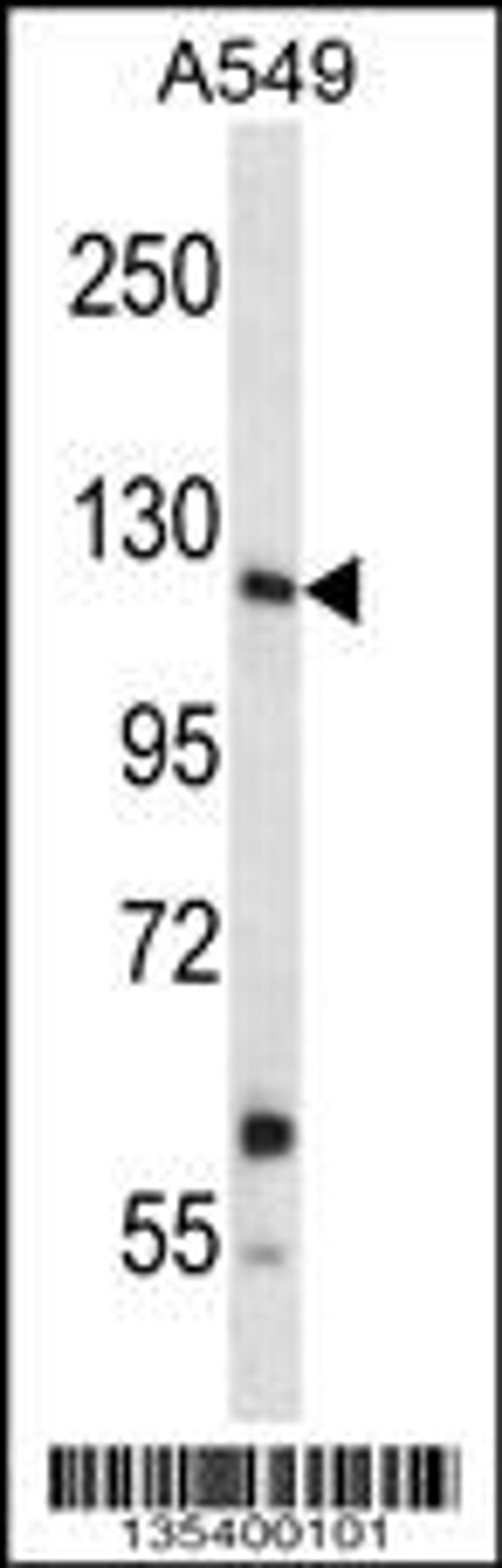 Western blot analysis in A549 cell line lysates (35ug/lane).