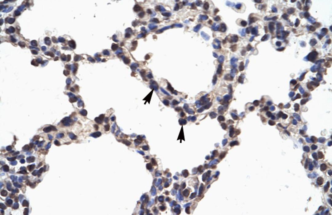 Antibody used in IHC on Human Lung.