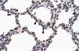 Antibody used in IHC on Human Lung.