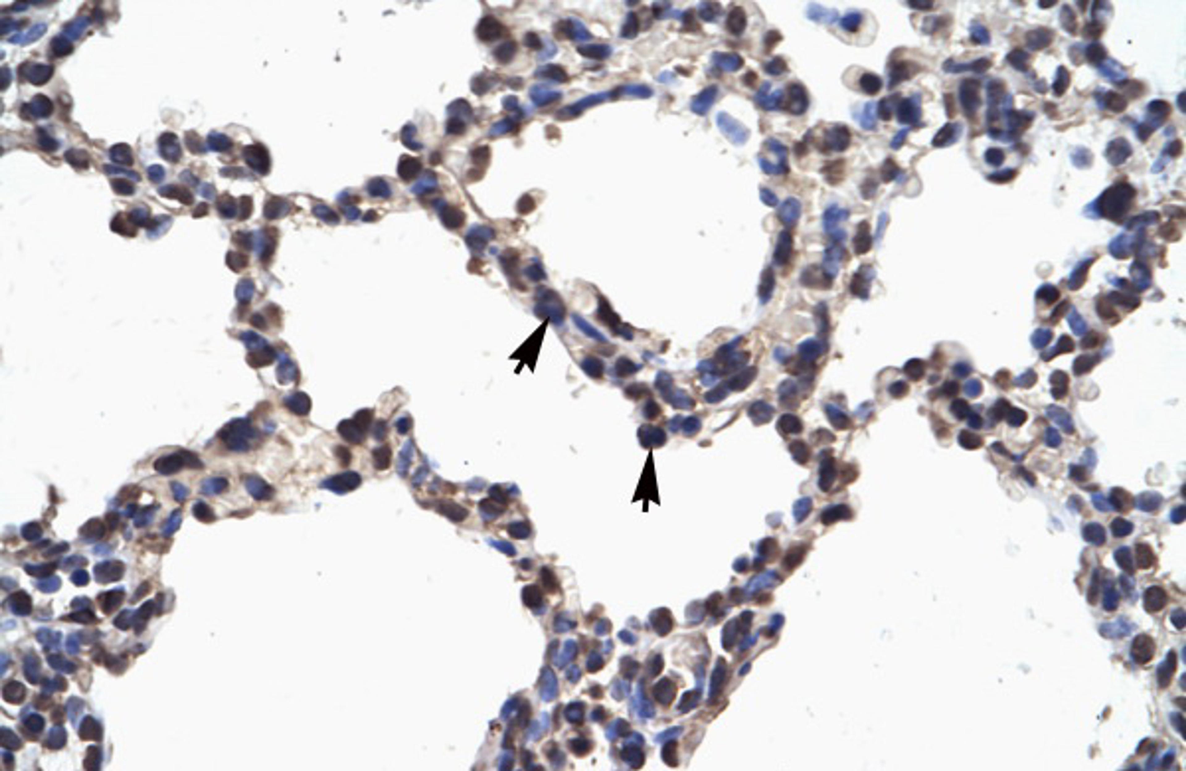 Antibody used in IHC on Human Lung.