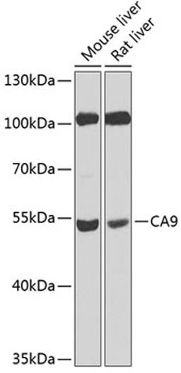 Western blot - CA9 antibody (A1658)