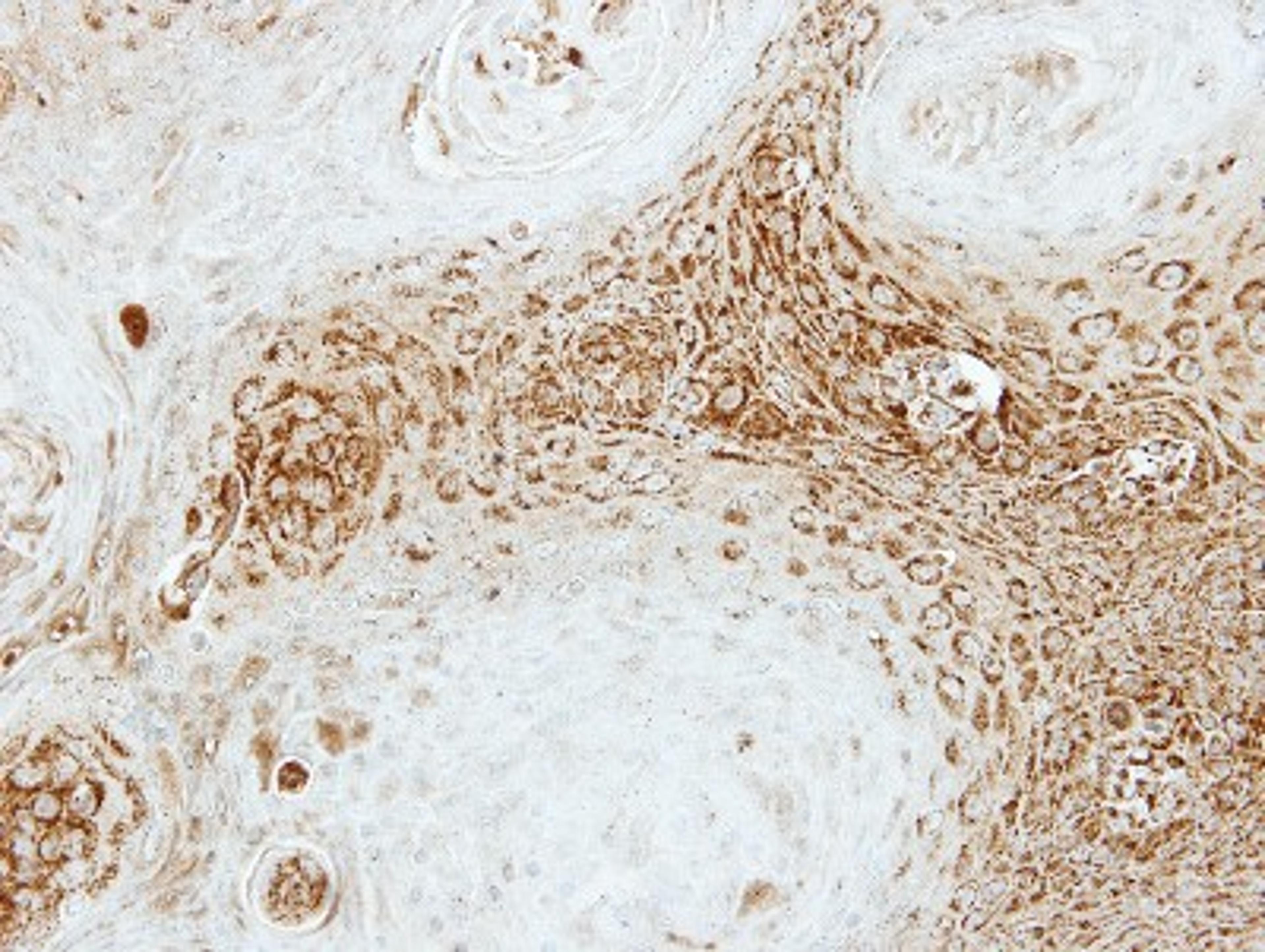 Immunohistochemistry-Paraffin: SEC23A Antibody [NBP1-32773] - Paraffin-embedded Cal27 xenograft, using antibody at 1:500 dilution.