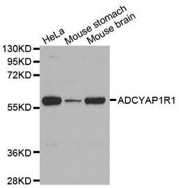 Western blot analysis of extracts of various cell lines using ADCYAP1R1 antibody