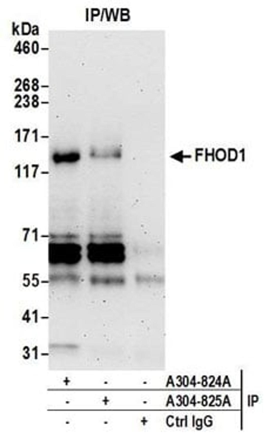 Detection of human FHOD1 by western blot of immunoprecipitates.