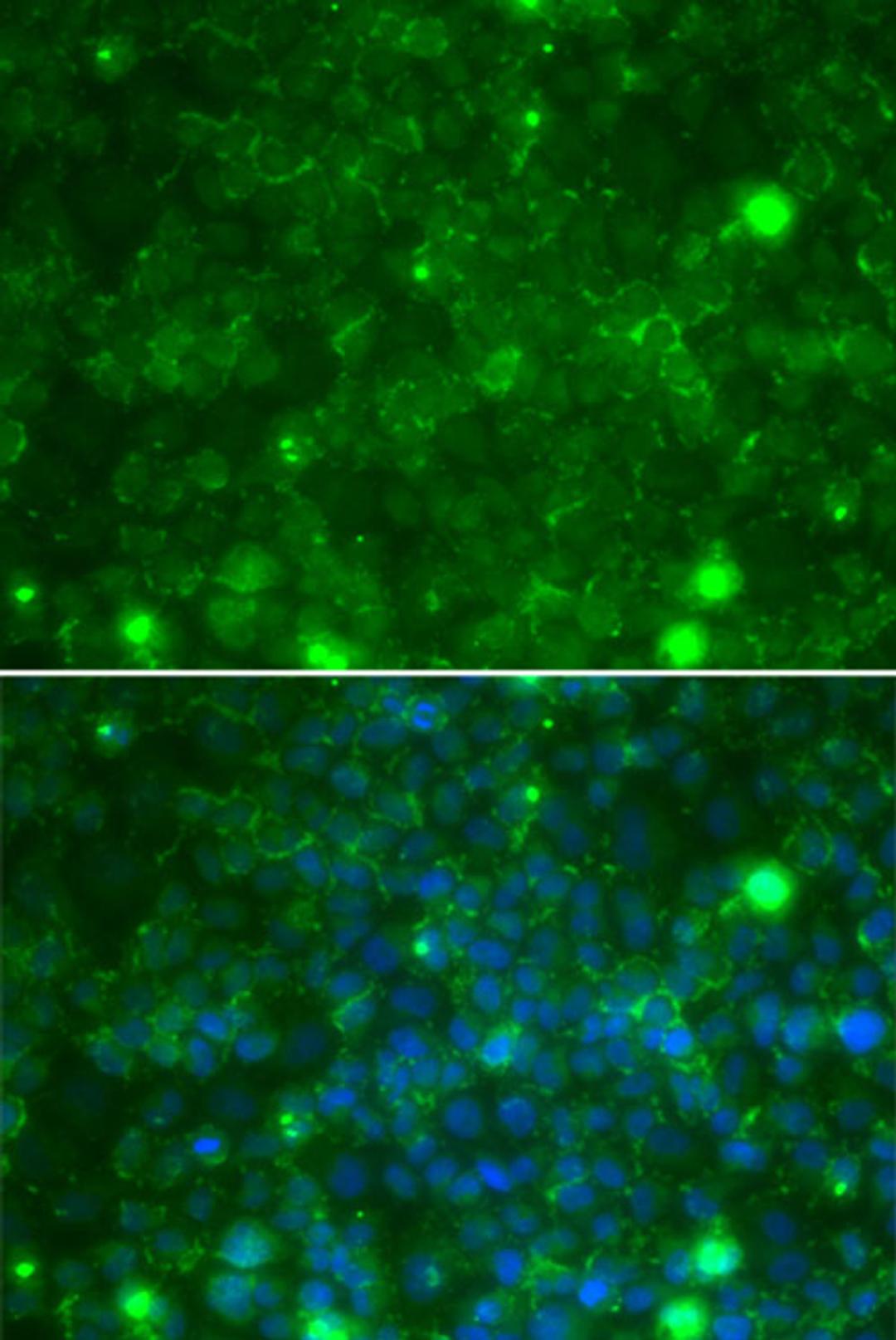 Immunofluorescence - TIMP3 antibody (A1511)