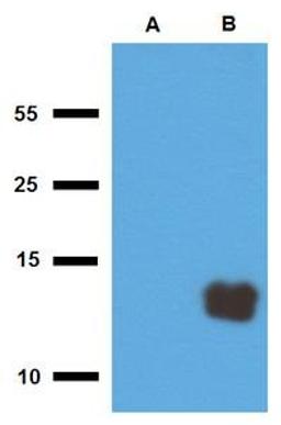 WB analysis of cell lysate of non-transfected E. coli (Lane1), cell lysate of Tb10.3-transfected E. coli (Lane2) using Tb10.3 antibody