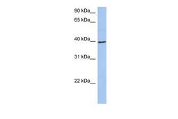 Antibody used in WB on Human 721_B at 0.2-1 ug/ml.