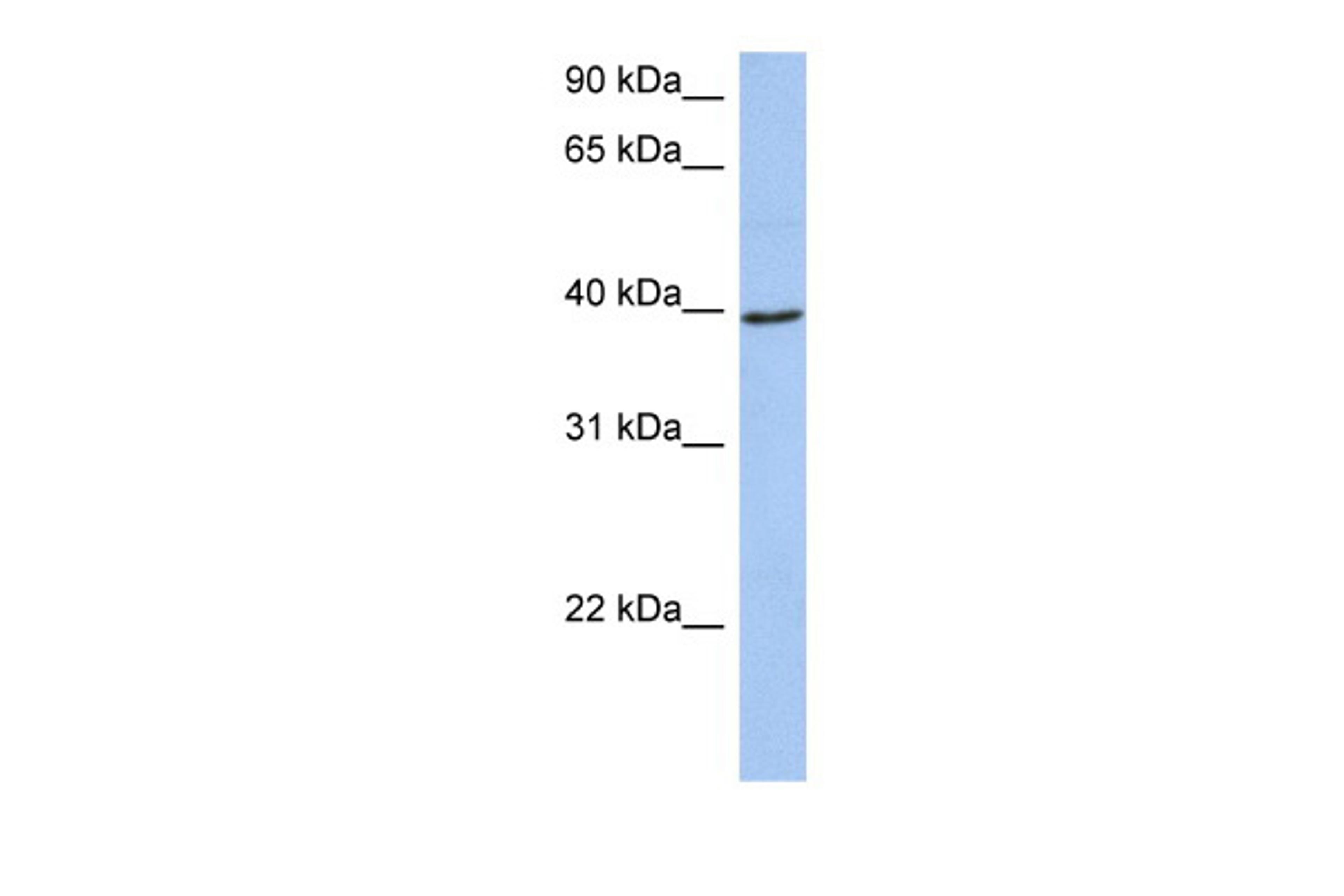 Antibody used in WB on Human 721_B at 0.2-1 ug/ml.