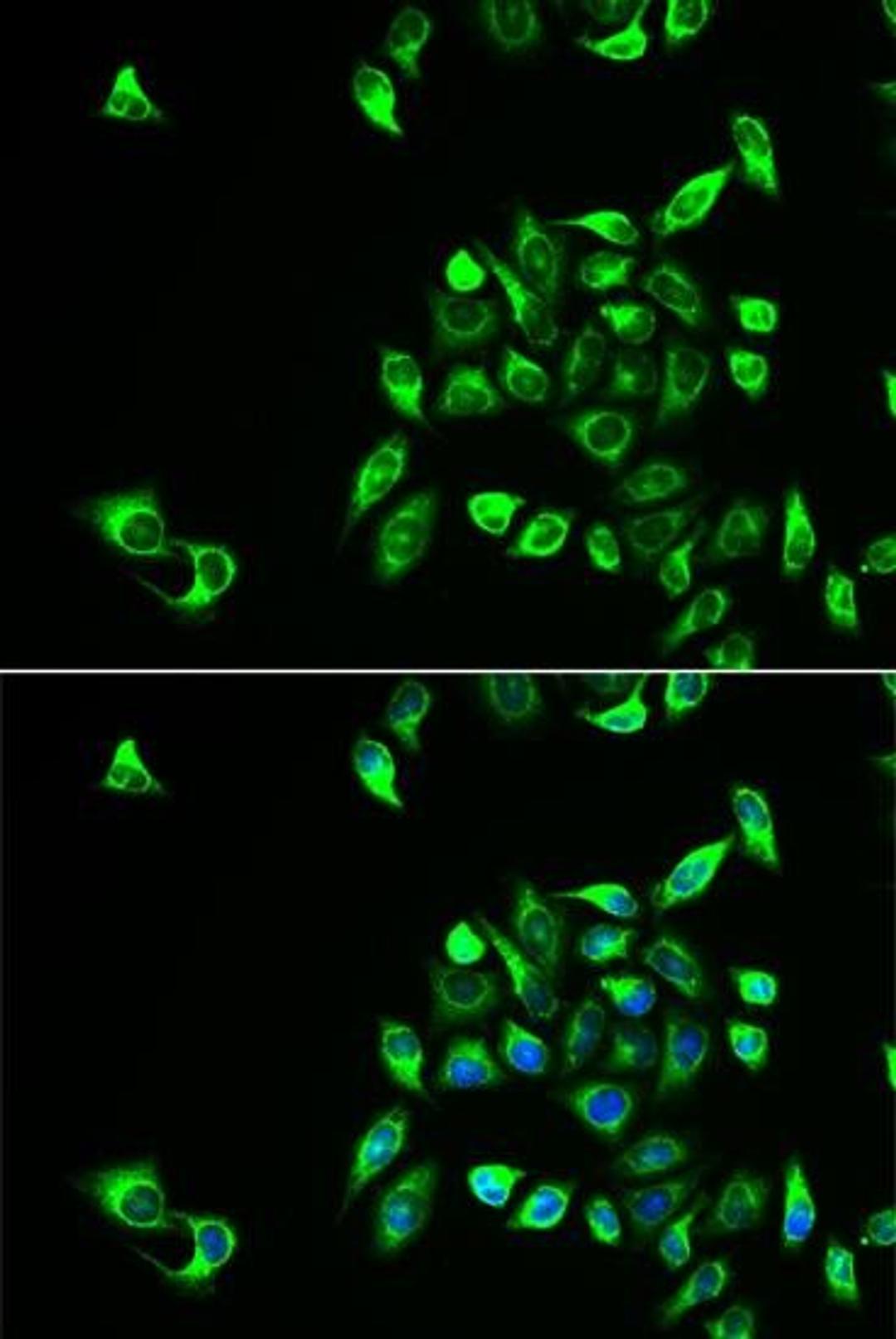 Immunofluorescence analysis of HeLa cell using CSNK1A1L antibody