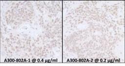 Detection of mouse SUPT6H by immunohistochemistry.