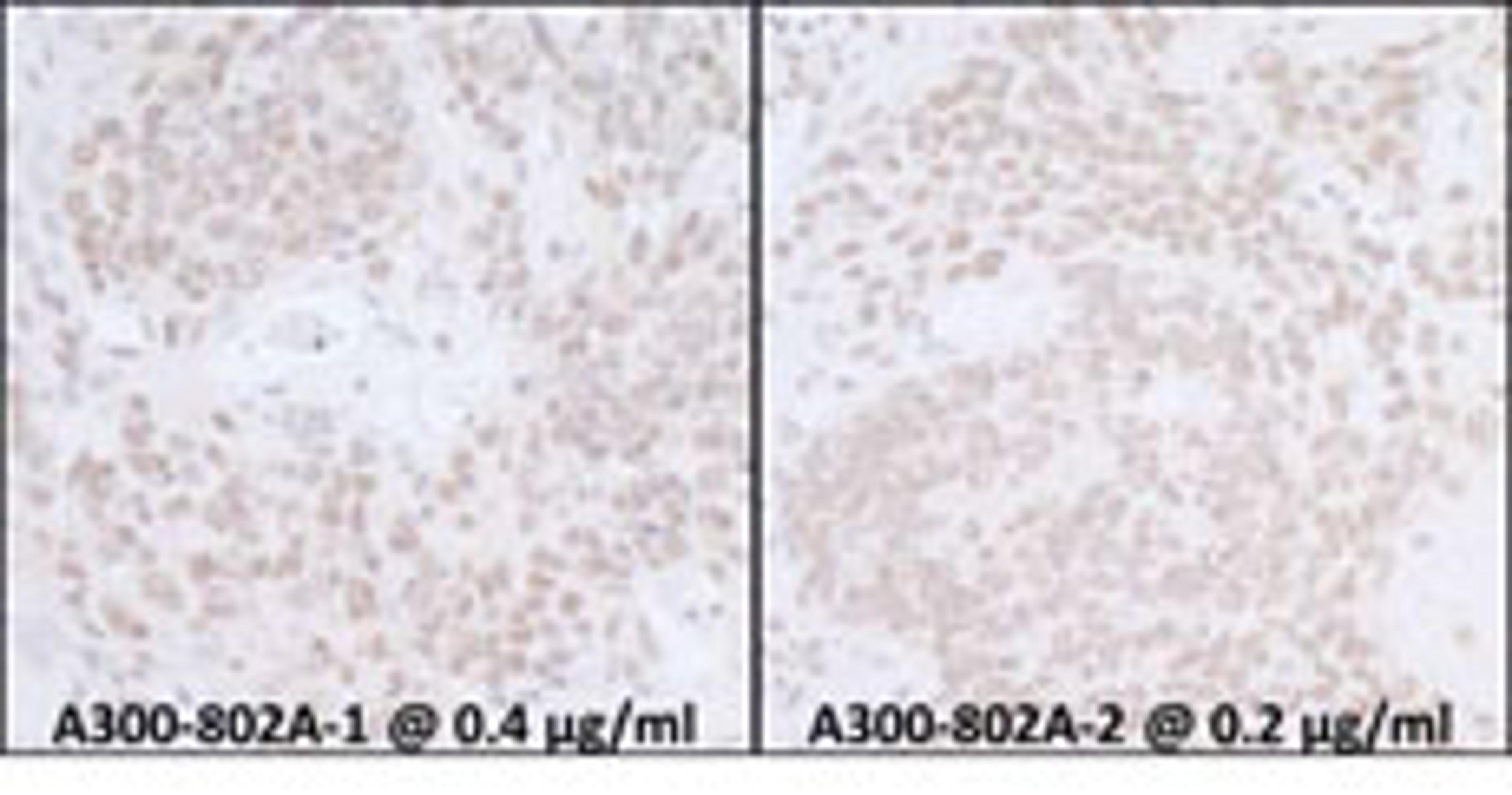 Detection of mouse SUPT6H by immunohistochemistry.