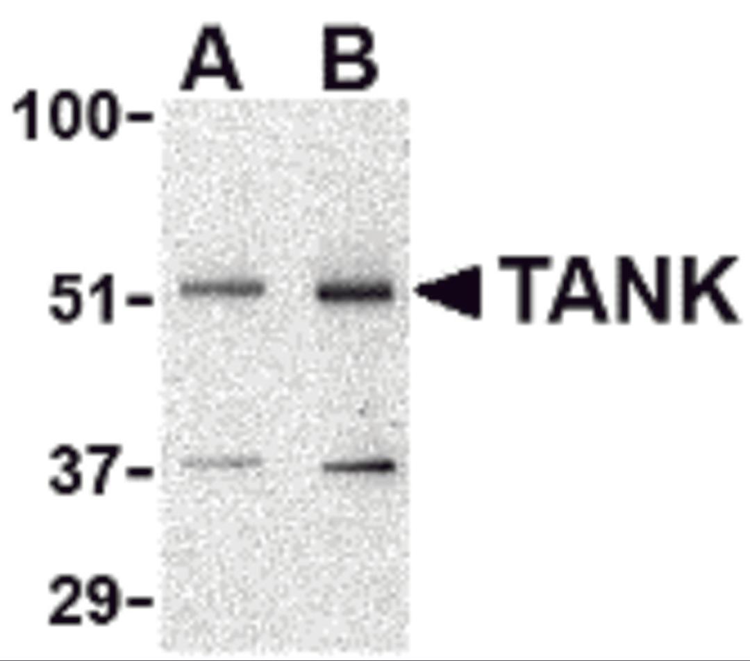 Western blot analysis of TANK in Daudi cell lysate with TANK antibody at (A) 0.5 and (B) 1 &#956;g/mL.