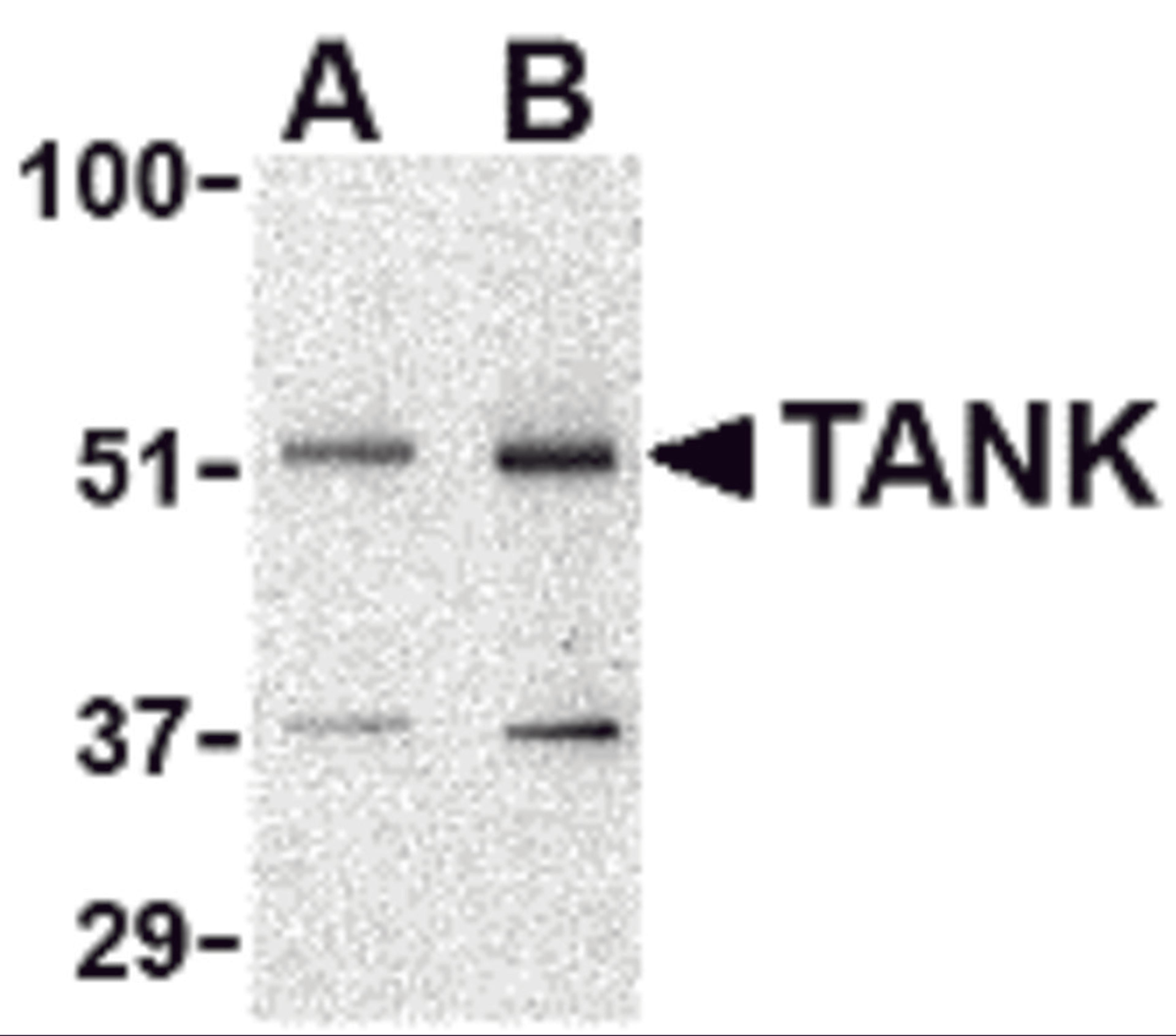 Western blot analysis of TANK in Daudi cell lysate with TANK antibody at (A) 0.5 and (B) 1 &#956;g/mL.