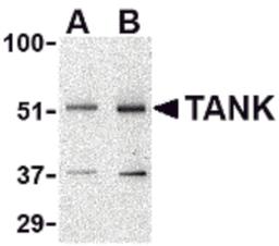Western blot analysis of TANK in Daudi cell lysate with TANK antibody at (A) 0.5 and (B) 1 μg/mL.