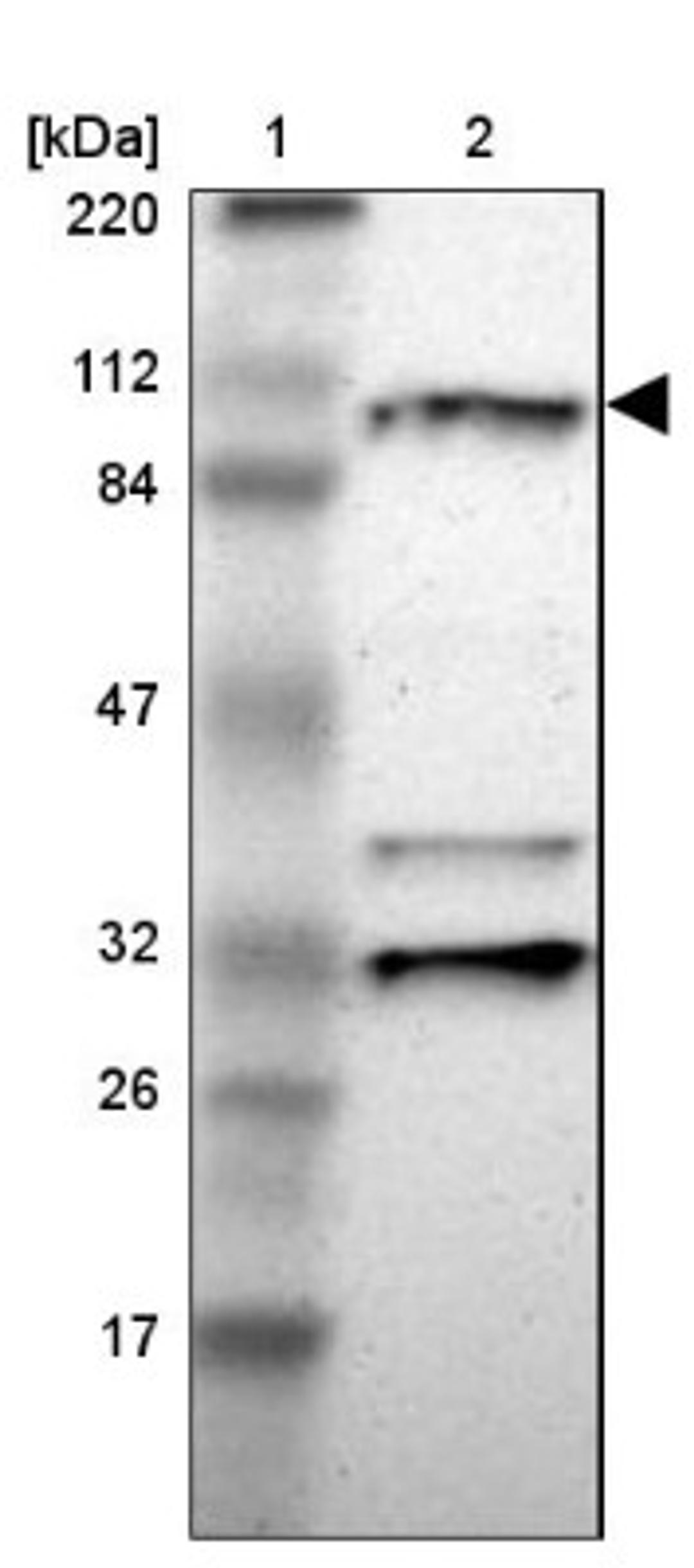 Western Blot: RNF213 Antibody [NBP1-88466] - Lane 1: Marker [kDa] 220, 112, 84, 47, 32, 26, 17<br/>Lane 2: Human cell line RT-4