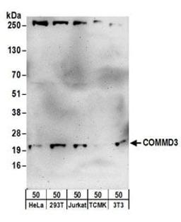 Detection of human and mouse COMMD3 by western blot.