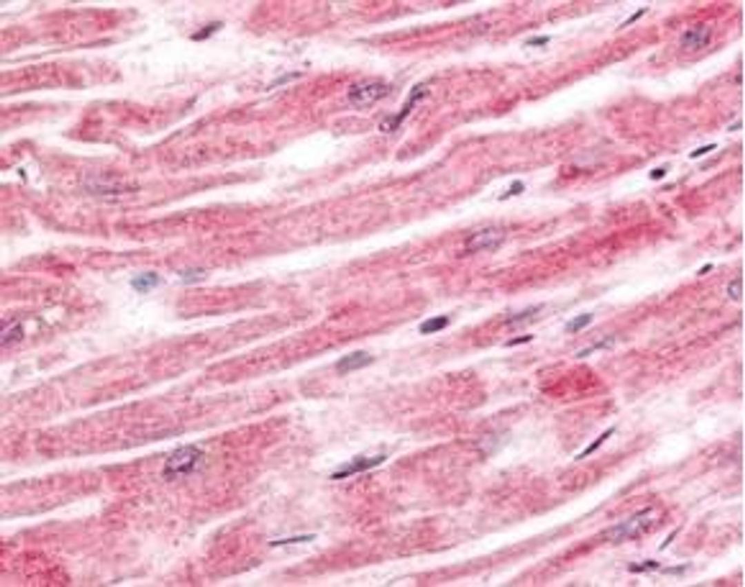 Immunohistochemical staining of human heart tissue using Sprouty-4 antibody