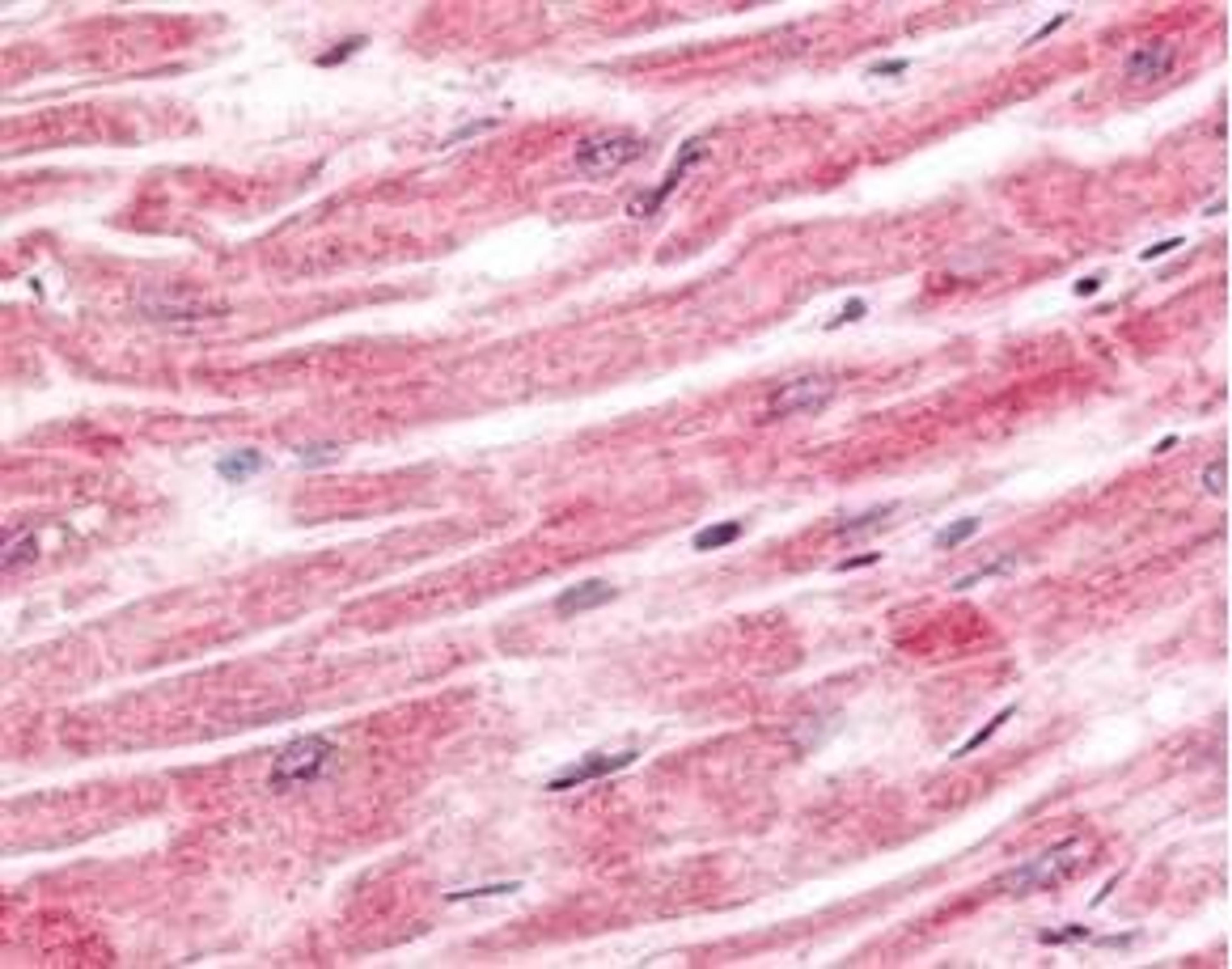 Immunohistochemical staining of human heart tissue using Sprouty-4 antibody