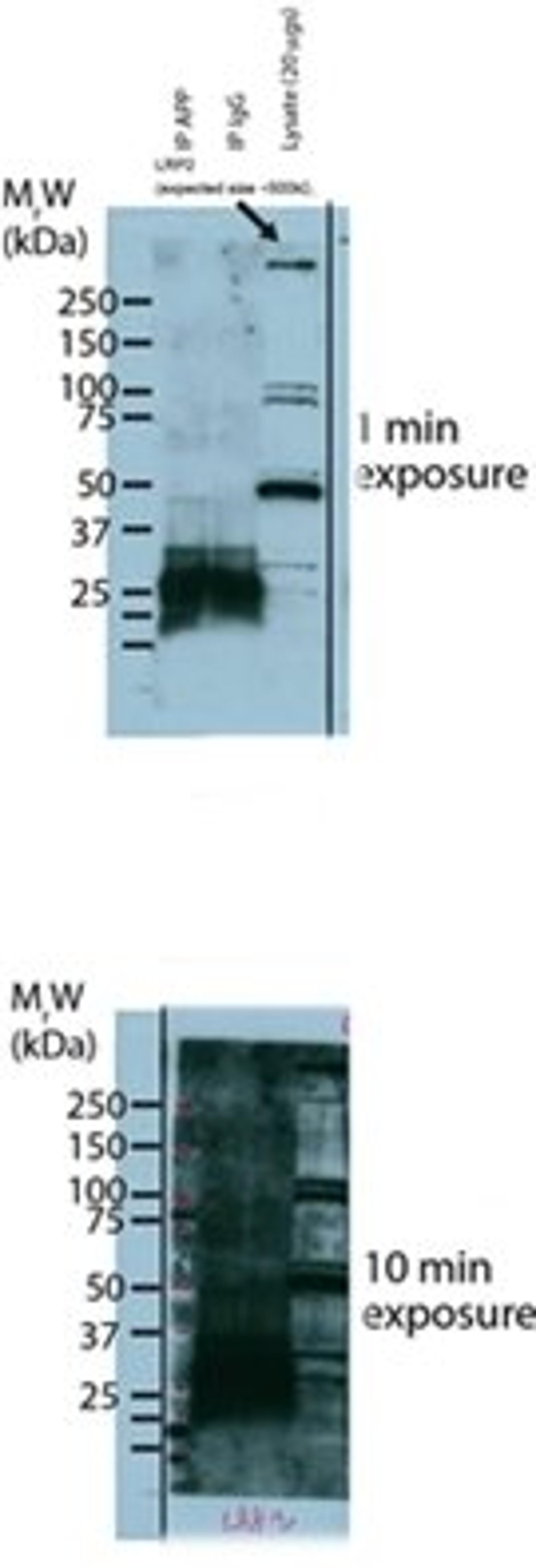 Western blot analysis of rat brain tissue using LRP2 antibody [Reviews]