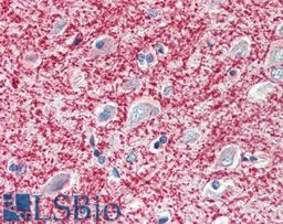 45-893 (5ug/ml) staining of paraffin embedded Human Cortex. Steamed antigen retrieval with citrate buffer pH 6, AP-staining.