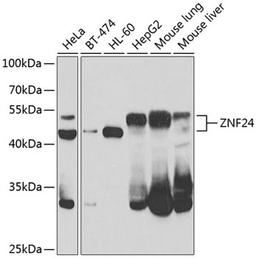 Western blot - ZNF24 antibody (A7500)