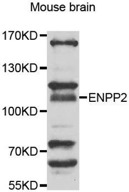 Western blot analysis of extracts of mouse brain using ENPP2 antibody