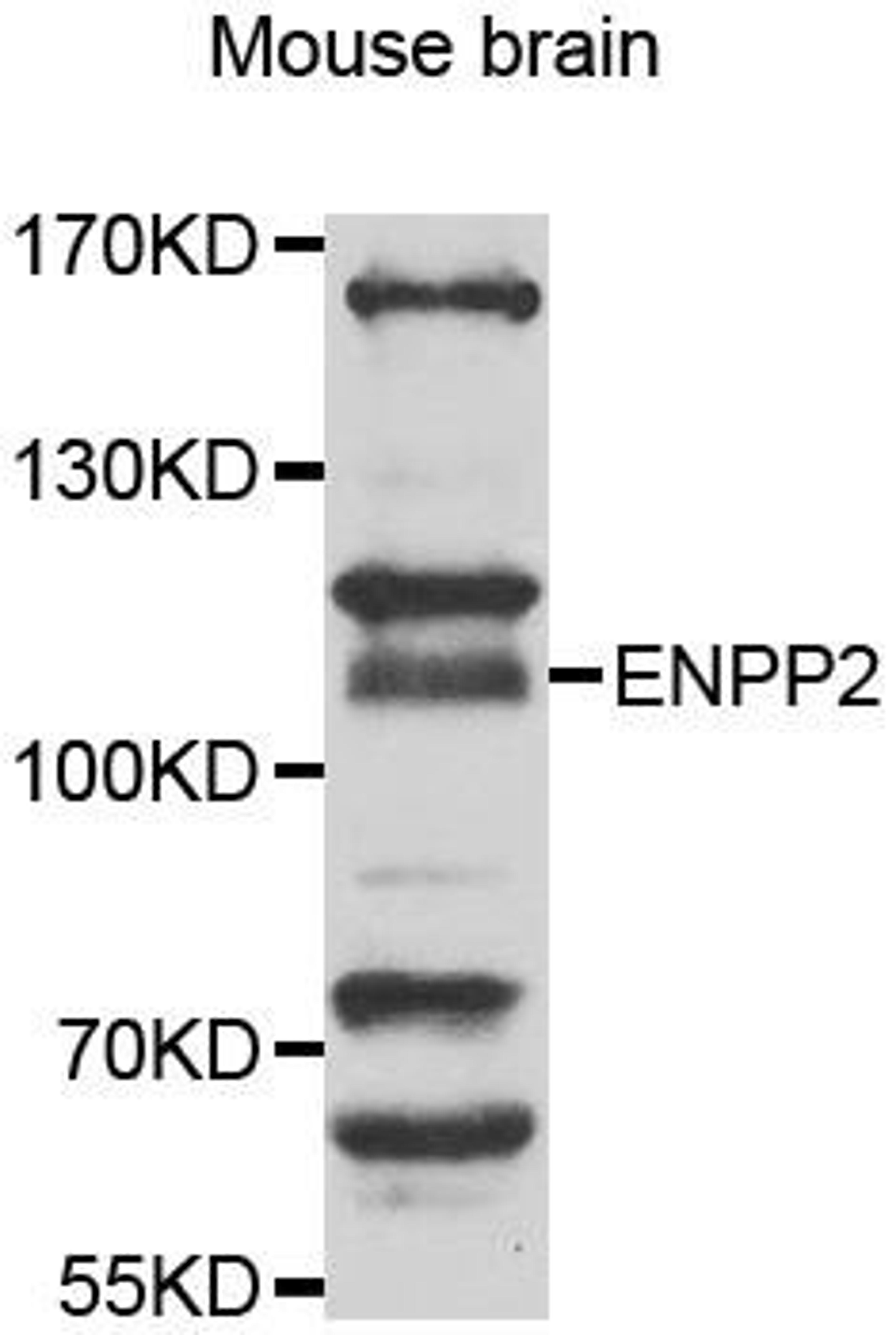 Western blot analysis of extracts of mouse brain using ENPP2 antibody