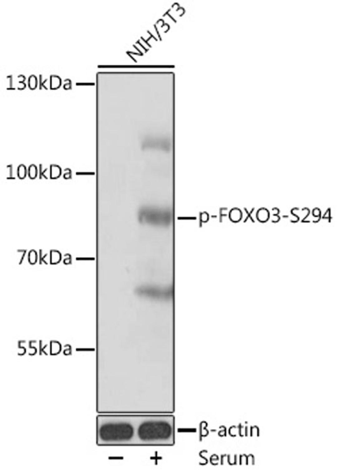 Western blot - Phospho-FOXO3-S294 antibody (AP0856)