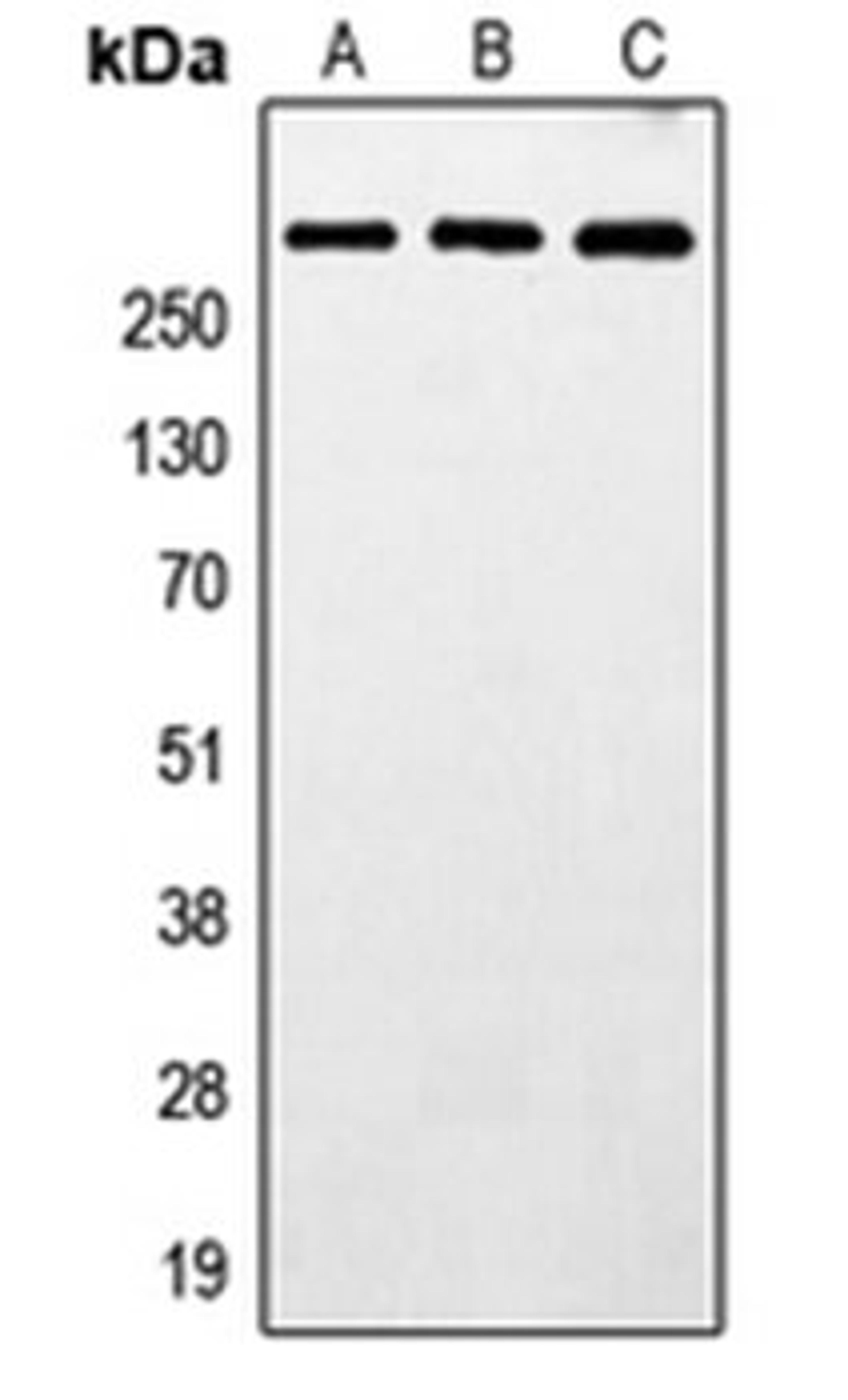 Western blot analysis of HeLa (Lane 1), SP2/0 (Lane 2), PC12 (Lane 3) whole cell lysates using MXRA5 antibody