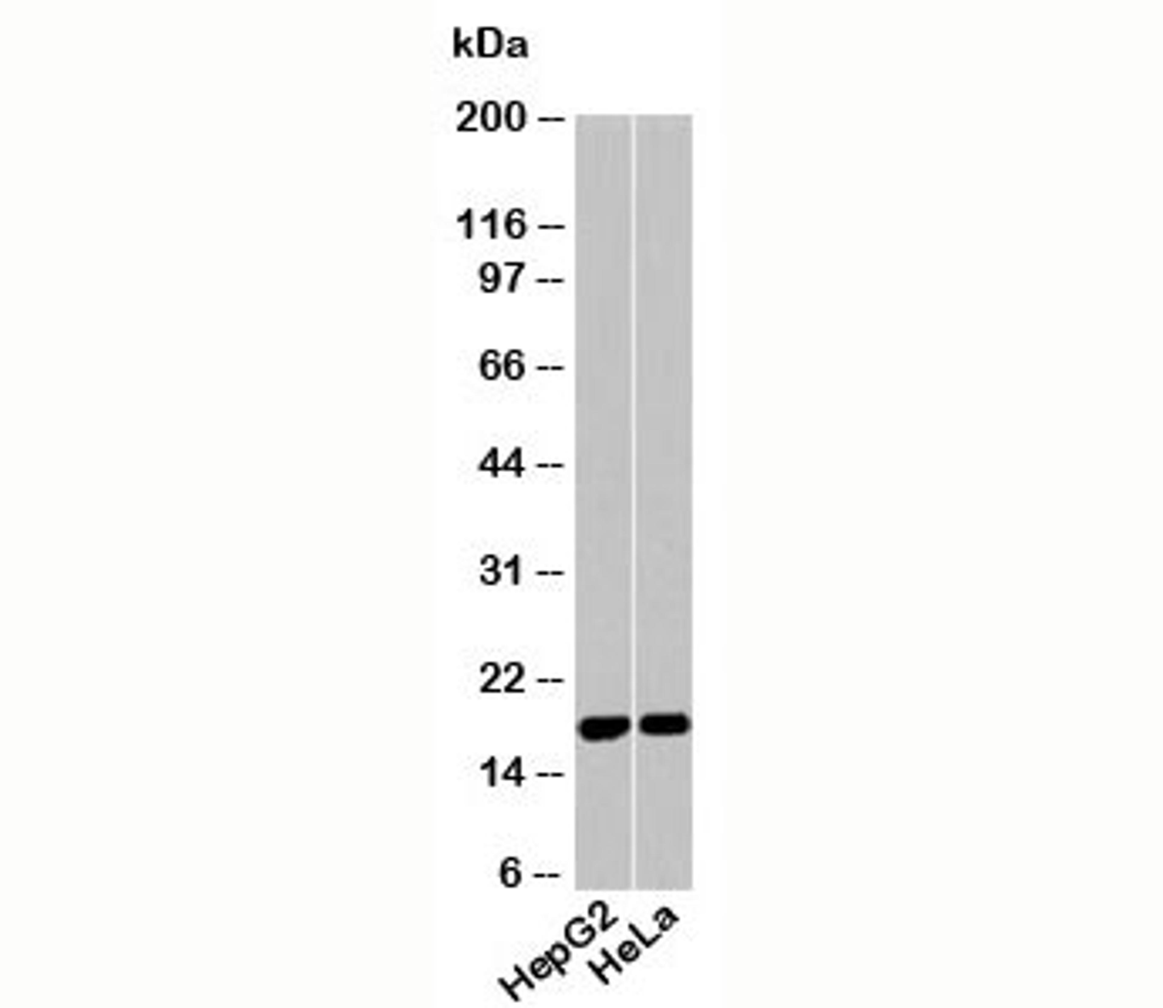 Western blot testing of human samples using Acid Phosphatase antibody at 1ug/ml.