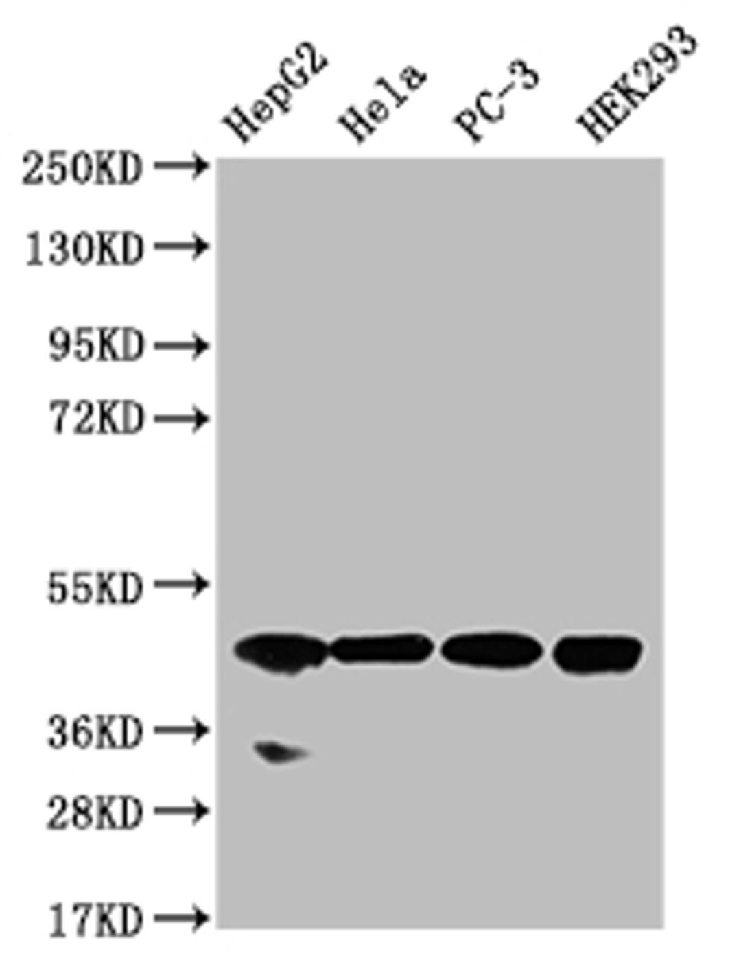 Western Blot. Positive WB detected in: HepG2 whole cell lysate, Hela whole cell lysate, PC-3 whole cell lysate, HEK293 whole cell lysate. All lanes: NSDHL antibody at 1:1000. Secondary. Goat polyclonal to rabbit IgG at 1/50000 dilution. Predicted band size: 42 kDa. Observed band size: 42 kDa.