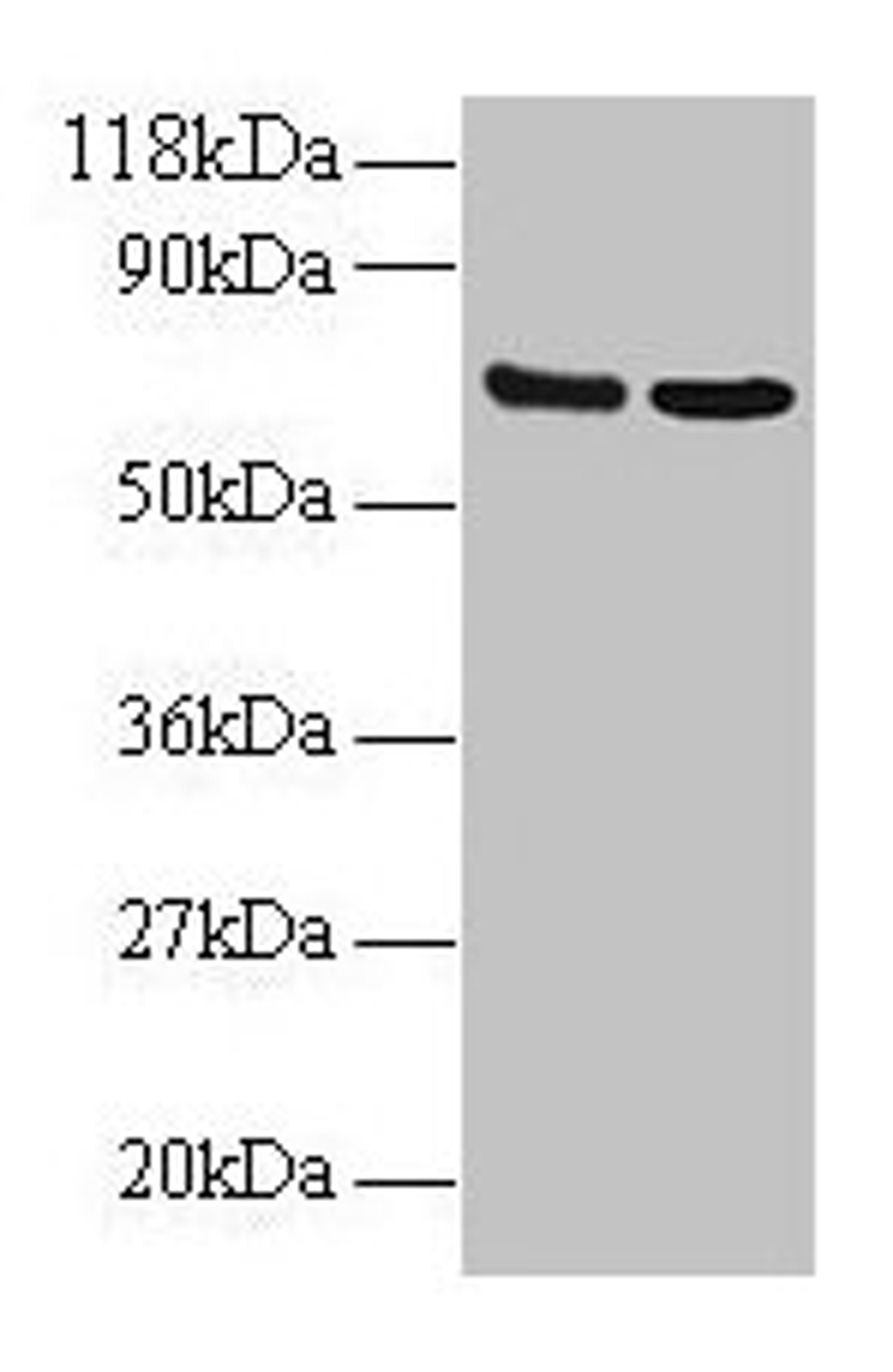 Western blot. All lanes: IFITM1 antibody at 2µg/ml. Lane 1: EC109 whole cell lysate. Lane 2: 293T whole cell lysate. Secondary. Goat polyclonal to rabbit IgG at 1/15000 dilution. Predicted band size: 14 kDa. Observed band size: 70 kDa